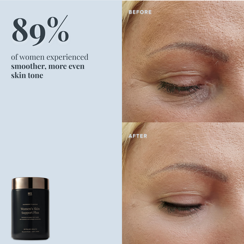Load image into Gallery viewer, Women's Skin Support Plus
